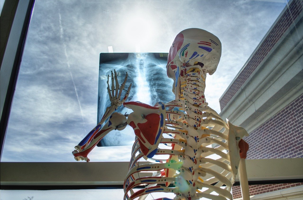 4. X-Rays (1895) – Seeing Inside the Human Body (image credits: pixabay)