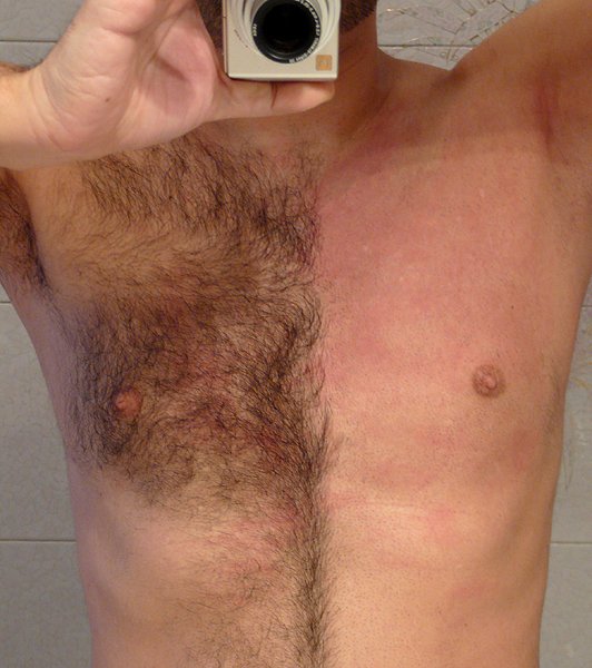 The Battle with Body Hair (image credits: wikimedia)
