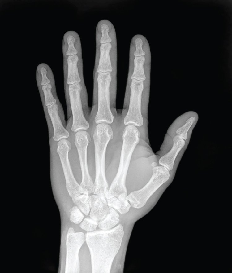 3. X-Rays: Seeing Through the Human Body (image credits: wikimedia)