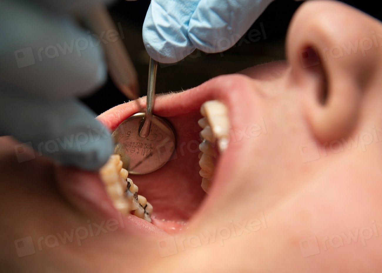 Prisoner's $300,000 Dental Victory (image credits: rawpixel)