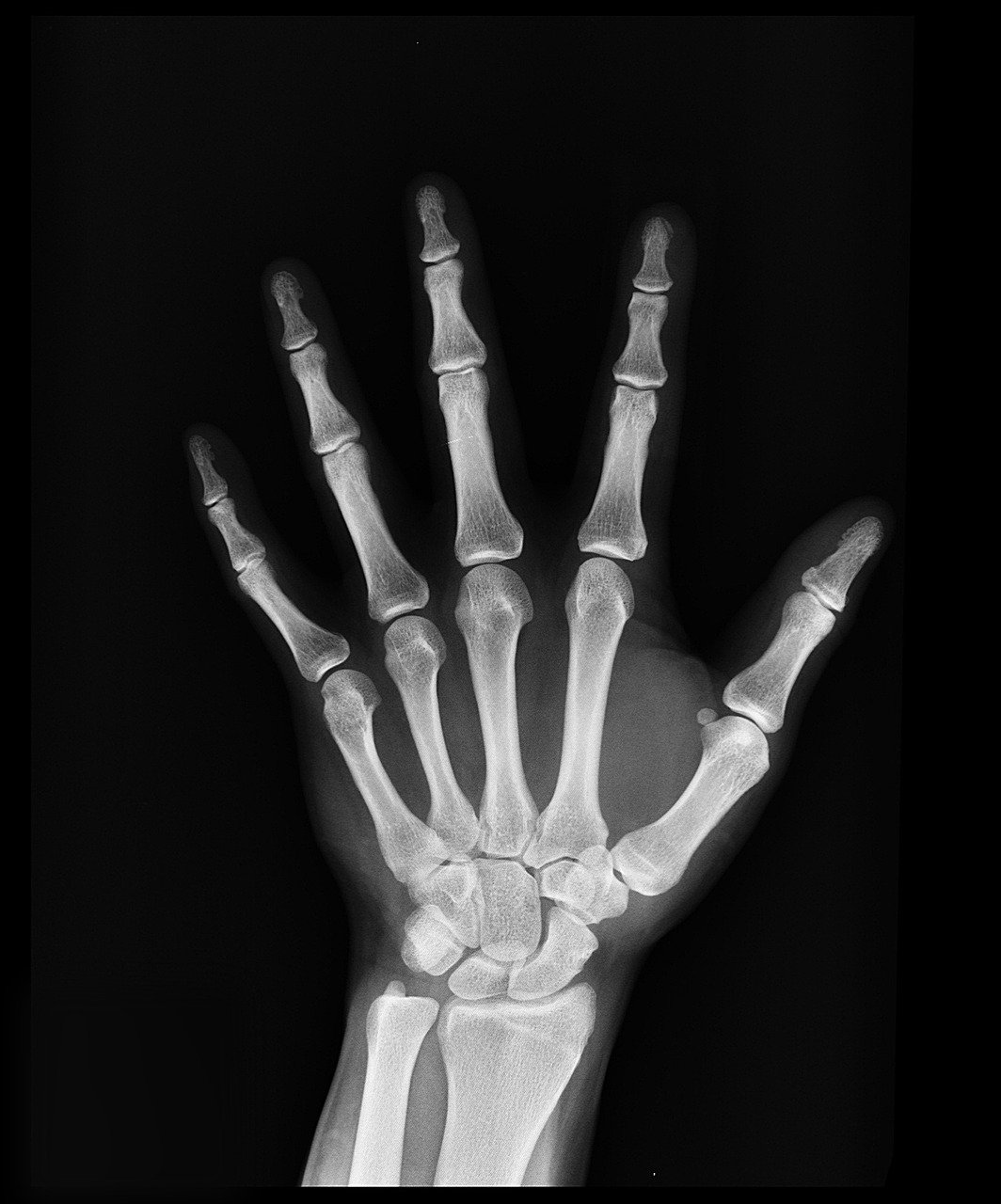 The Accidental Discovery of X-rays (image credits: pixabay)