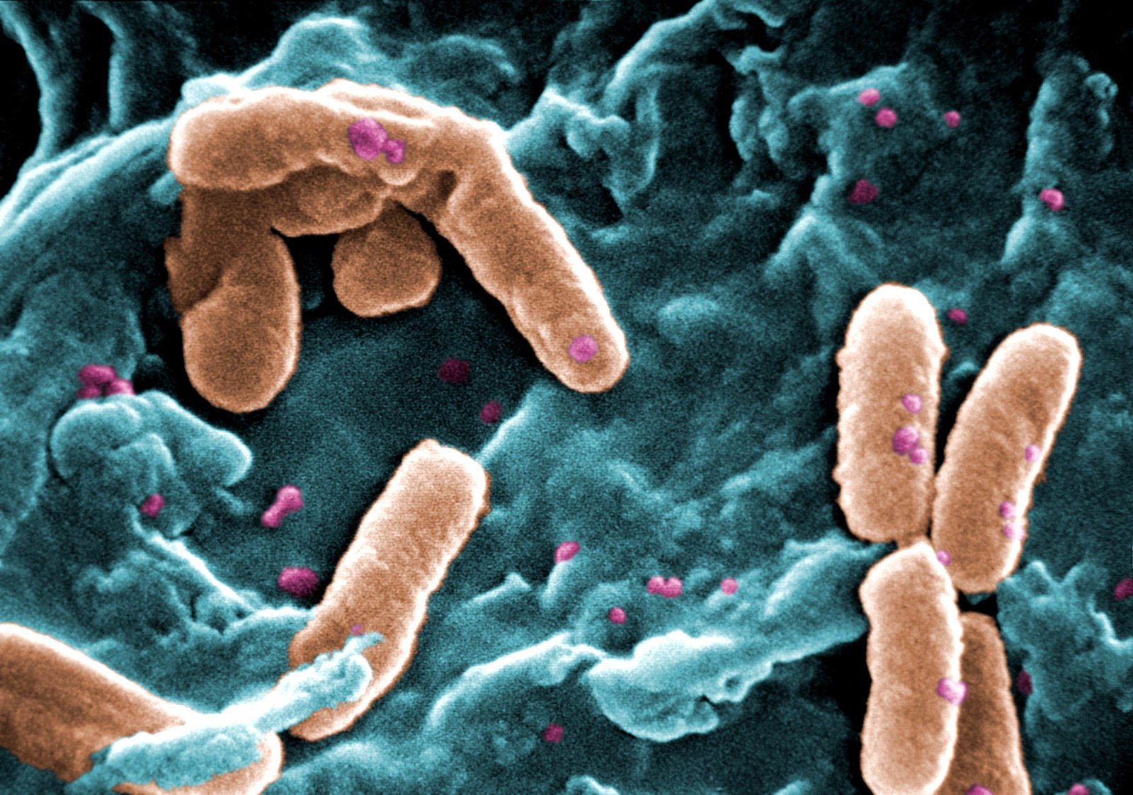 Germ Theory: Invisible Killers (image credits: wikimedia)