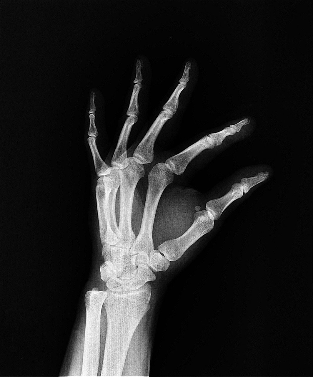 X-rays: Illuminating the Invisible (image credits: pixabay)