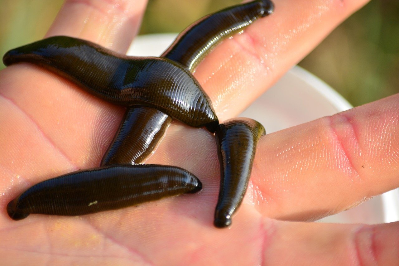 Leech Therapy (image credits: pixabay)