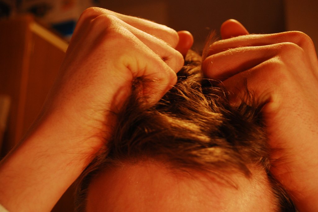 Trichotillomania (Hair Pulling Disorder) (image credits: wikimedia)