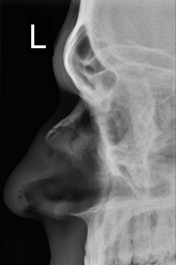X-rays: Seeing Through the Human Body by Accident (image credits: wikimedia)