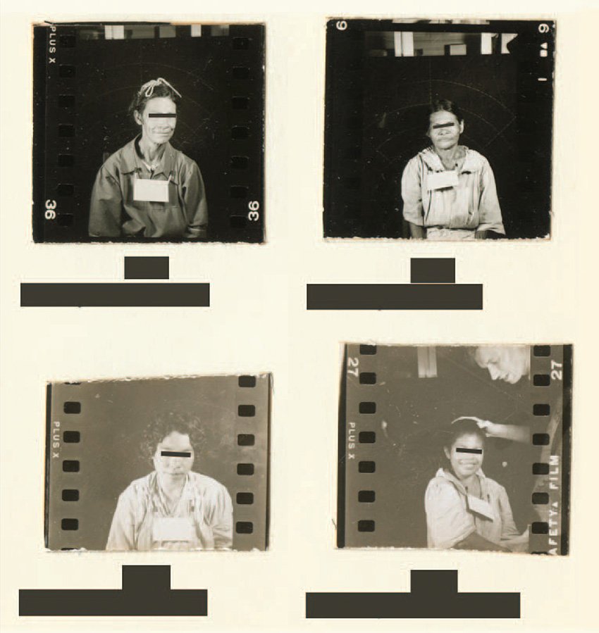 The Guatemala Syphilis Experiments (1940s): Deliberate Infection Without Consent (image credits: wikimedia)