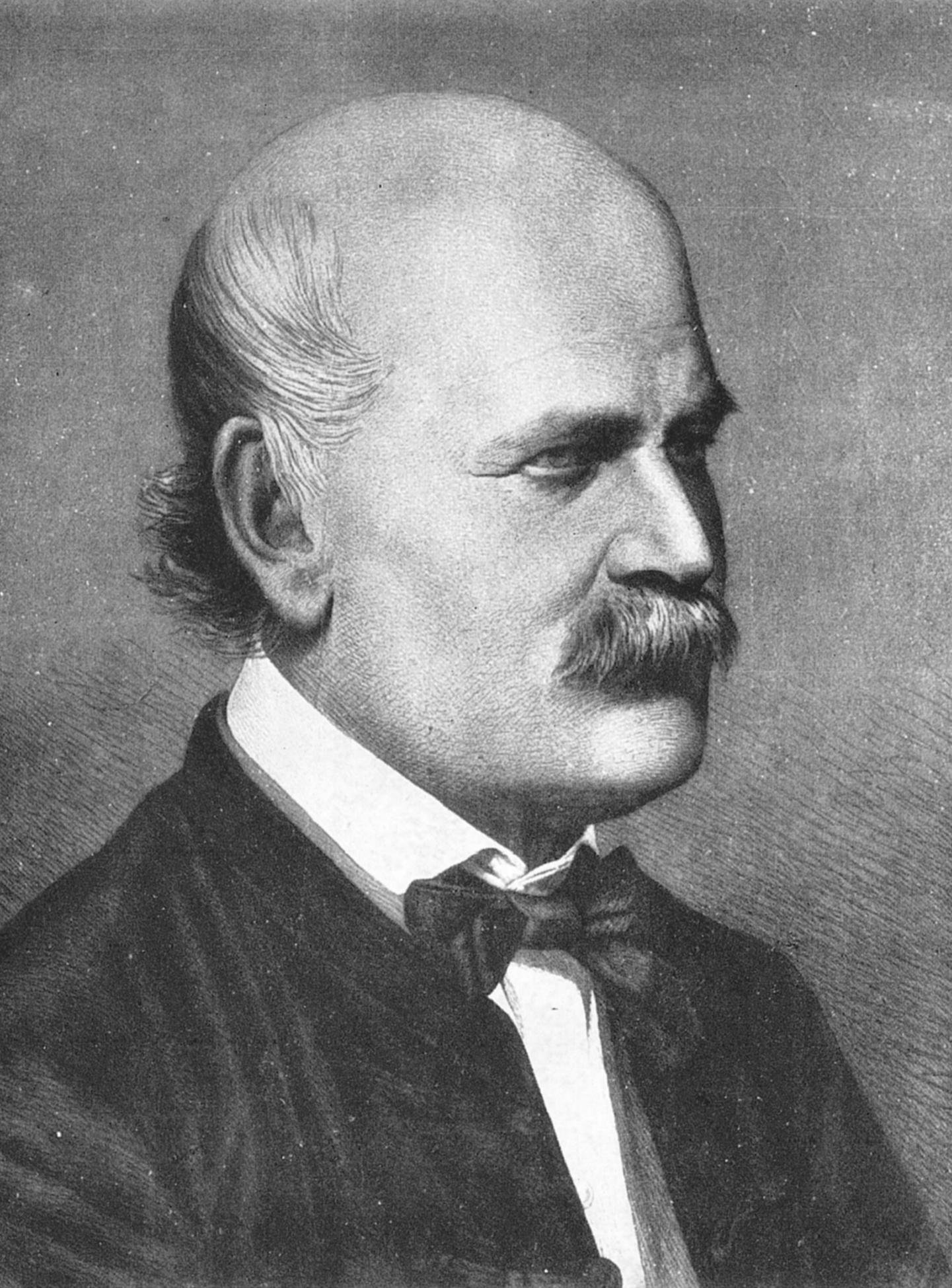 Ignaz Semmelweis: The Handwasher Who Saved Millions (image credits: wikimedia)