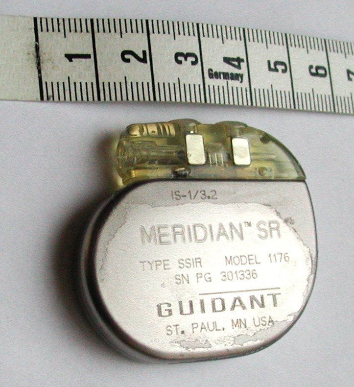 Pacemaker: A Heartbeat Found by Error (image credits: wikimedia)