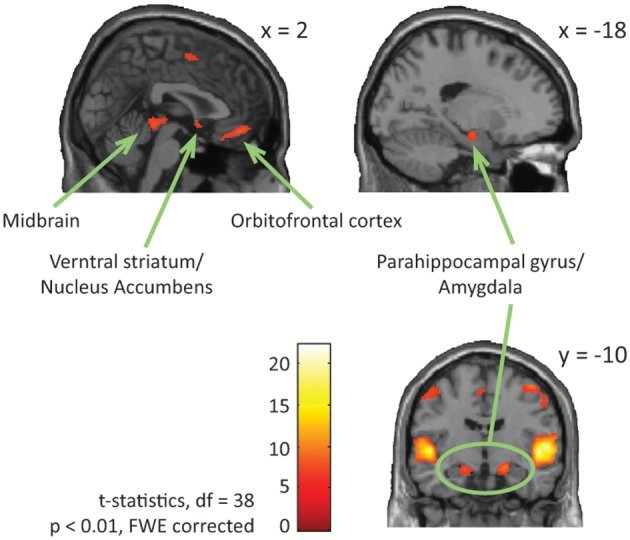 Dopamine Release (image credits: wikimedia)