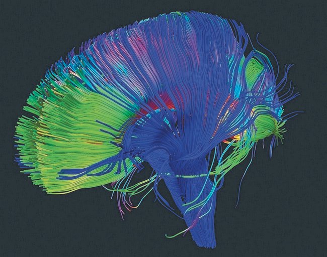Project Bluebird/Artichoke (image credits: flickr)