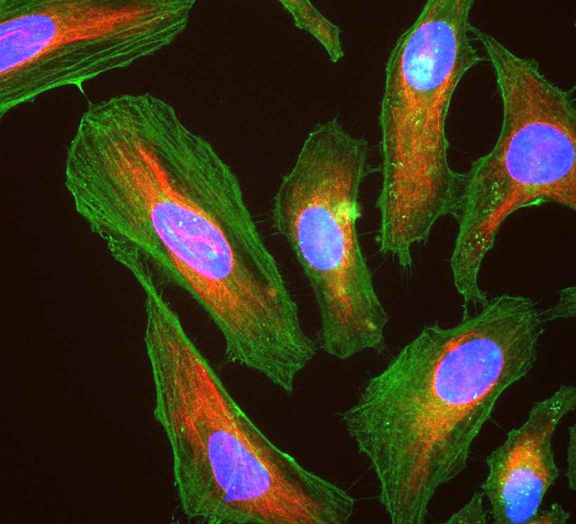 Henrietta Lacks: The Woman Whose Cells Changed Medicine (image credits: Immunocytochemistiry using antibodies to Actin and Vimentin, using fluorescent sandwich technique

Previously published: Not published, CC BY-SA 3.0, https://commons.wikimedia.org/w/index.php?curid=25768412)