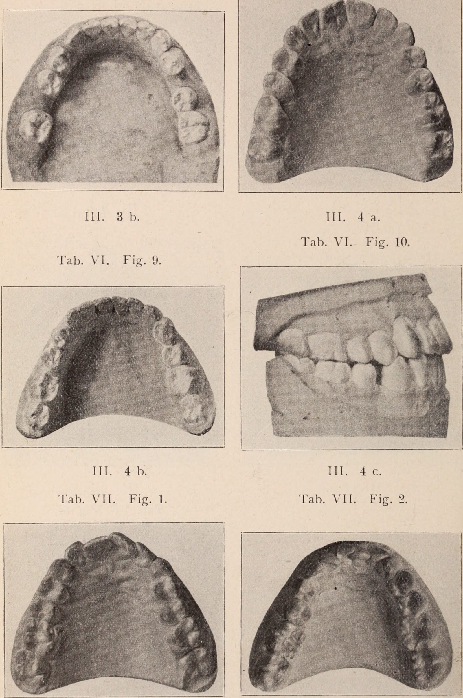 3. Washington's Dentures Were Not Made of Wood (By Internet Archive Book Images, No restrictions)