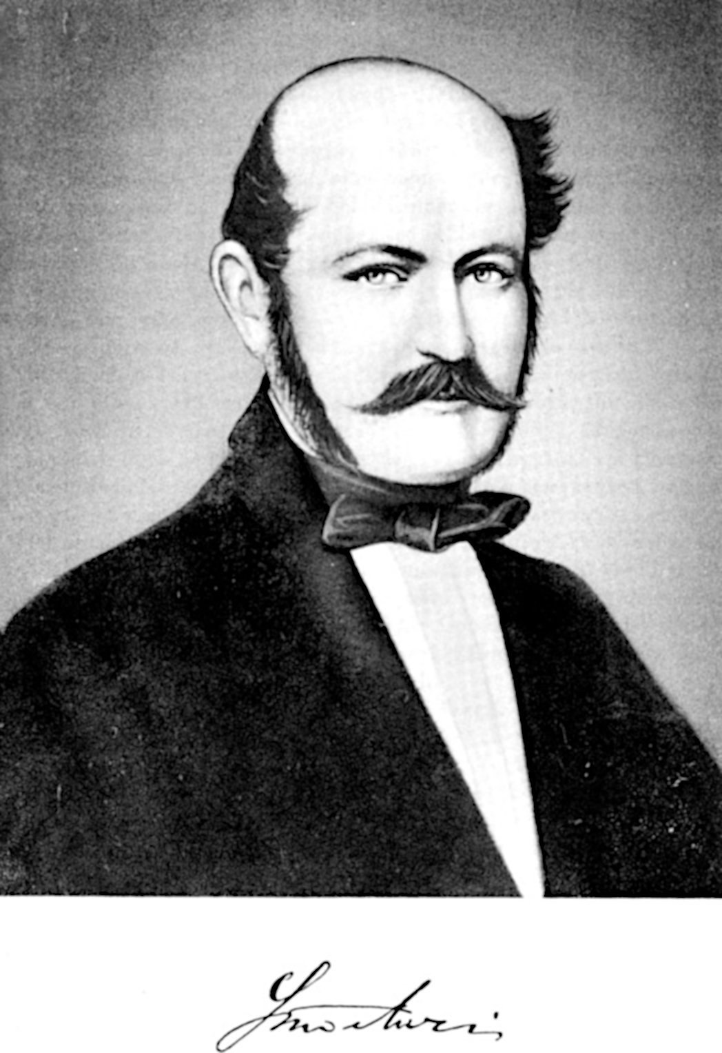 Ignaz Semmelweis (Sigerist, Henry E. (1965)       Große Ärzte, München, Deutschland:  J.F. Lehmans Verlag (5. Auflage) (1. Auflage 1958)   plate 61 p 324, Public domain)