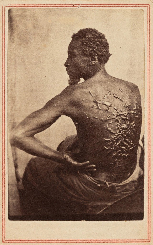 The Scourged Back (Image Credits: Rawpixel)